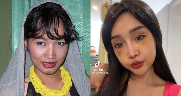 dulu dan kini Lucinta Luna usai oplas © berbagai sumber
