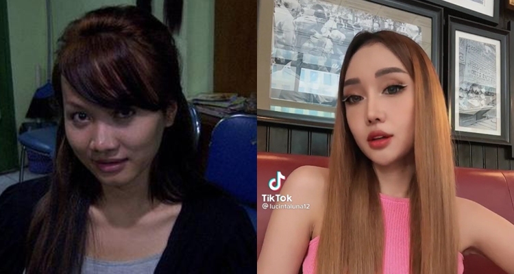 dulu dan kini Lucinta Luna usai oplas © berbagai sumber