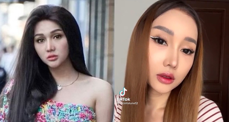 dulu dan kini Lucinta Luna usai oplas © berbagai sumber
