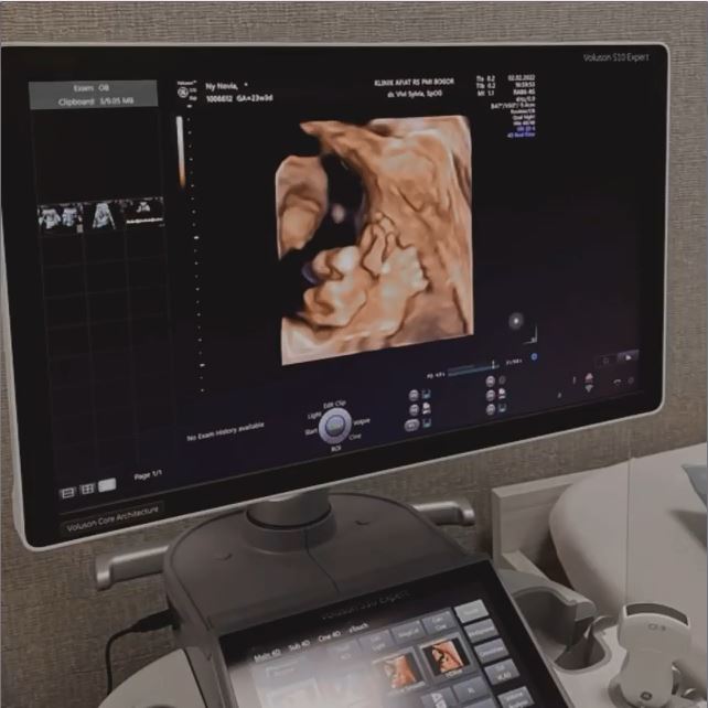 Cerita perjuangan hamil Novia Giana © Instagram/@noviagianan Cerita perjuangan hamil Novia Giana © Instagram/@noviagianan