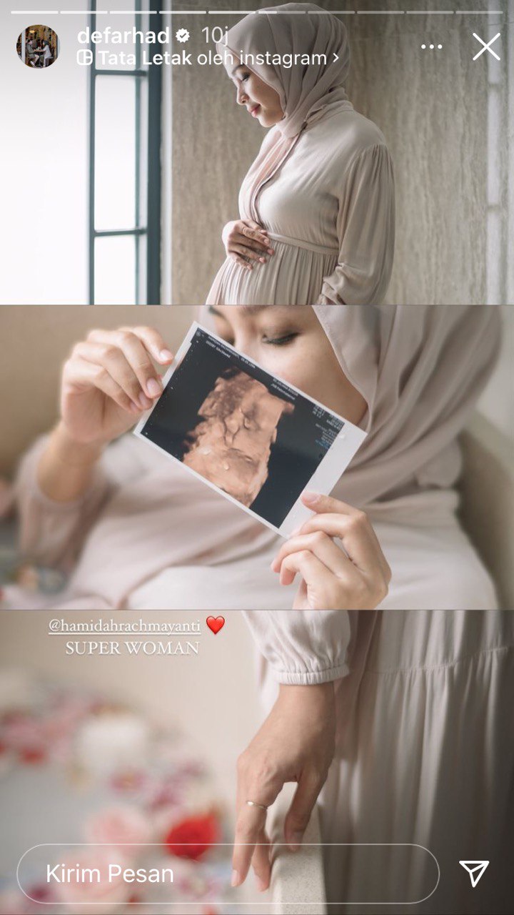11 Momen Hamidah Rachmayanti lahiran, kontraksi saat maternity shoot