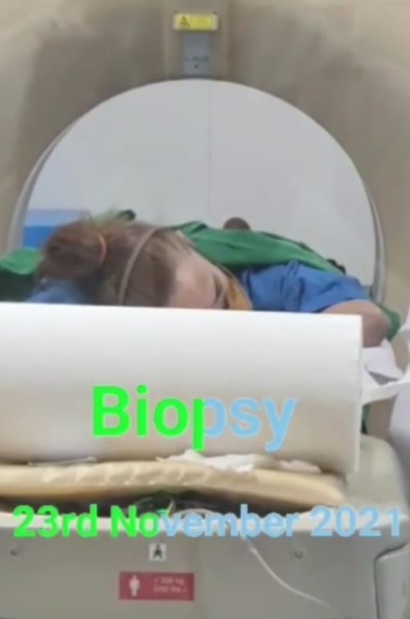 perjuangan kiki fatmala lawan kanker stadium 4 © instagram