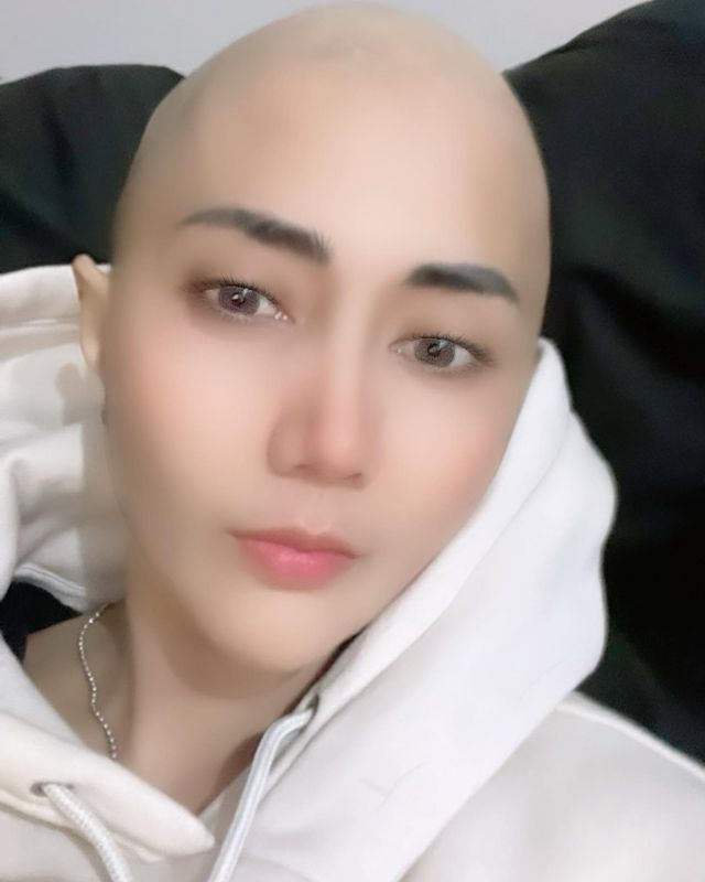 perjuangan Aida Saskia lawan kanker payudara © Instagram/@aidasaskia.new