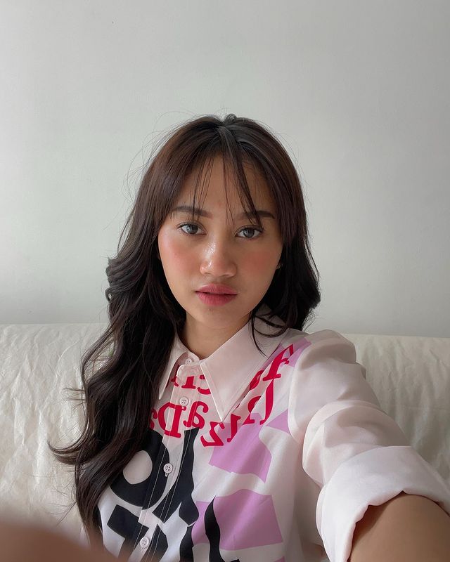 Permesta Dhyaz alami infeksi implan © Instagram/@permestadhyaz Permesta Dhyaz alami infeksi implan © Instagram/@permestadhyaz