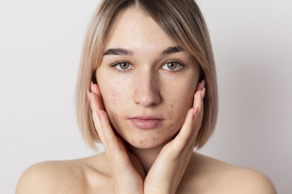 Cara merawat kulit wajah kombinasi dengan mudah Berbagai sumber
