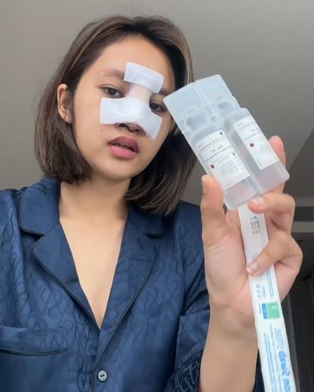 Potret kondisi Permesta Dhyaz usai angkat implan  © berbagai sumber