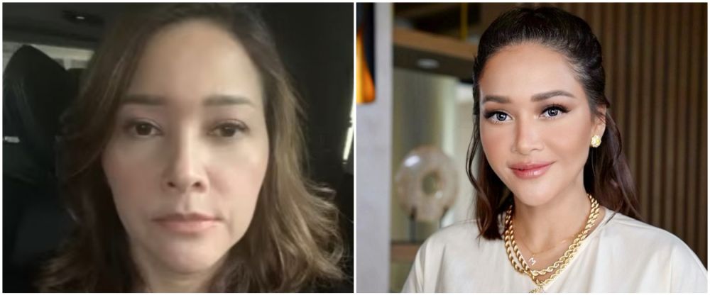 Maia Estianty sebelum dan usai botox-laser © Instagram