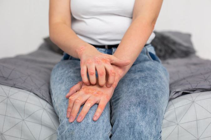 Arti mimpi disengat lebah © 2022 berbagai sumber Arti mimpi disengat lebah © 2022 berbagai sumber