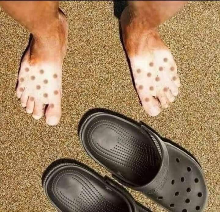 pakai sandal malah apes banget © berbagai sumber