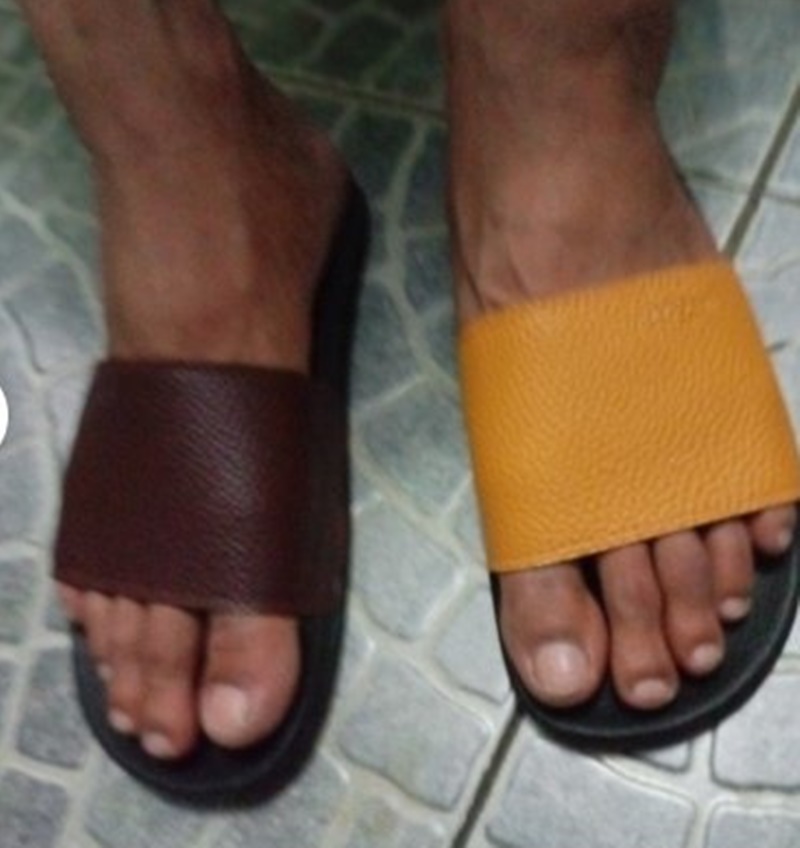 pakai sandal malah apes banget © berbagai sumber pakai sandal malah apes banget © berbagai sumber