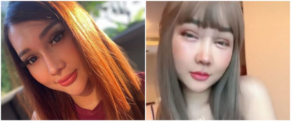 Lucinta Luna sebelum dan usai operasi © berbagai sumber