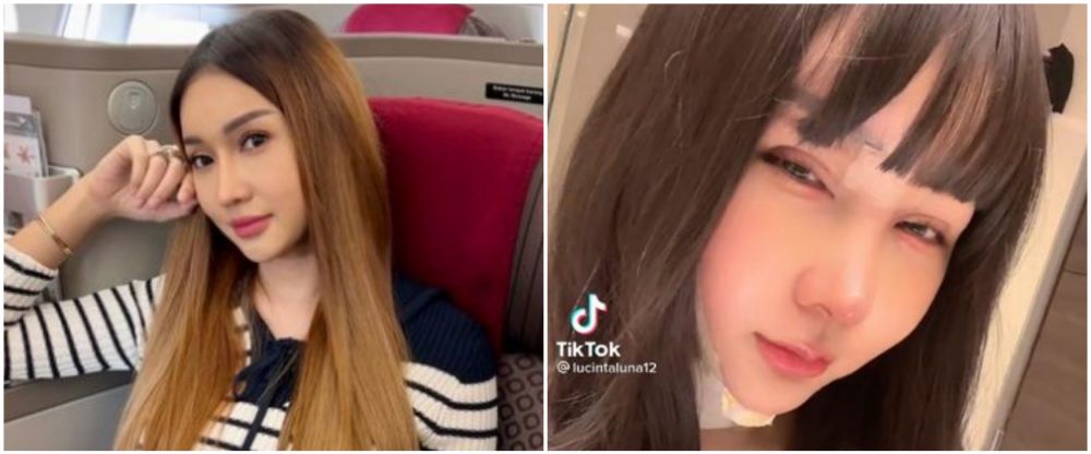 Lucinta Luna sebelum dan usai operasi © berbagai sumber