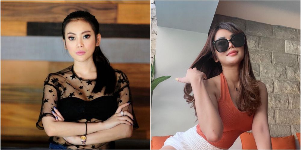 Potret dulu dan kini Daniar Masterchef usai operasi hidung Berbagai sumber