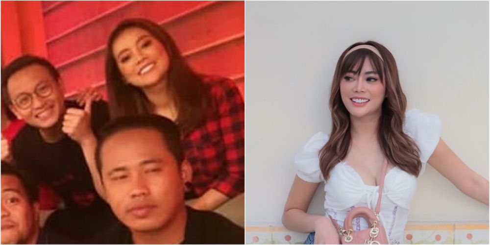 Potret dulu dan kini Daniar Masterchef usai operasi hidung Berbagai sumber