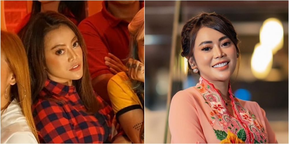 Potret dulu dan kini Daniar Masterchef usai operasi hidung Berbagai sumber