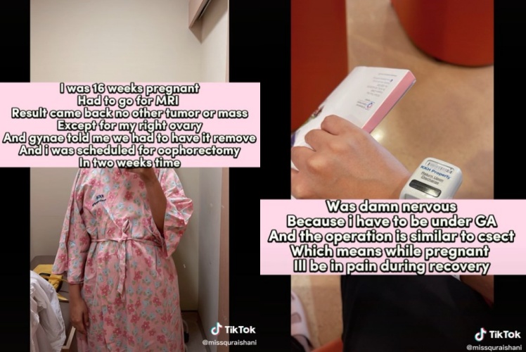 ibu hamil penderita kanker stadium 4 © TikTok