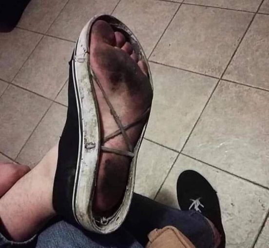 tingkah nyeleneh pakai sepatu © Facebook