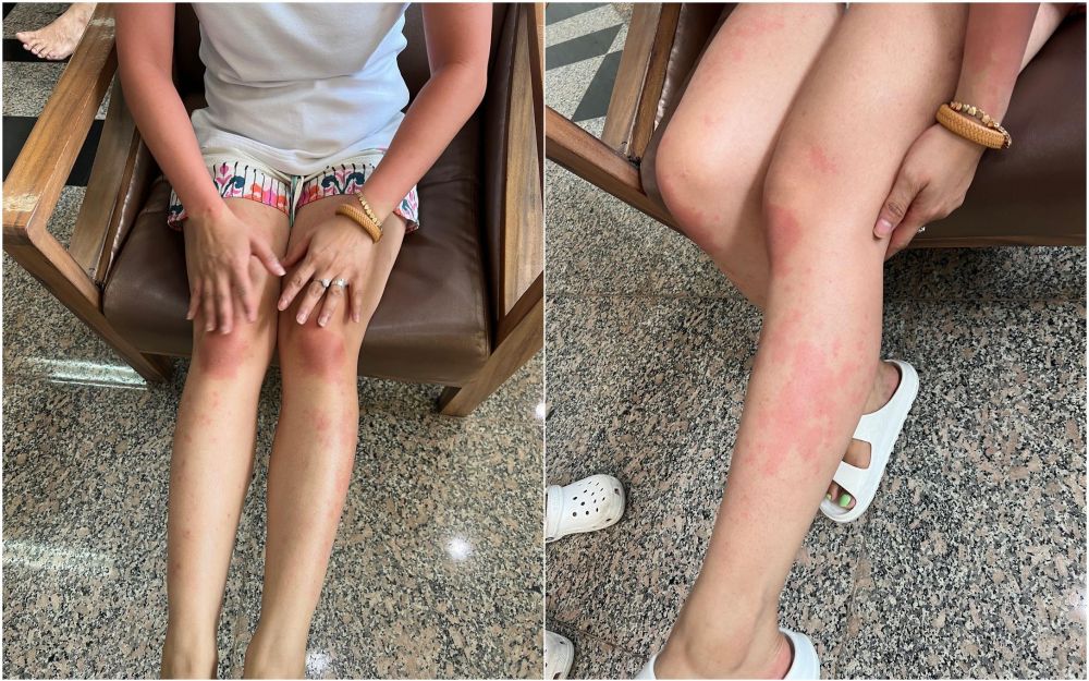 farida nurhan keracunan © Instagram