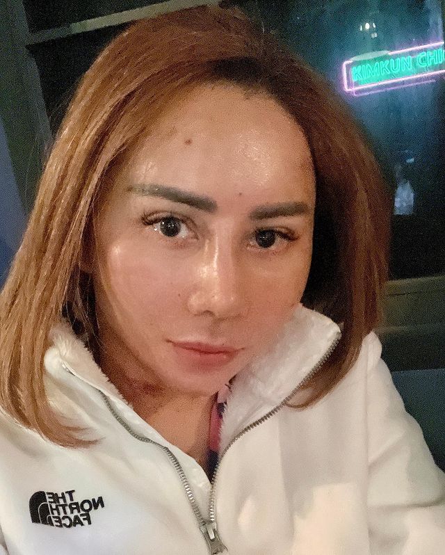 Potret terbaru Femmy Permatasari usai oplas berbagai sumber Potret terbaru Femmy Permatasari usai oplas berbagai sumber