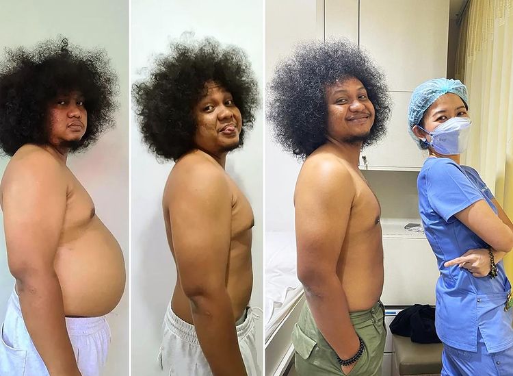 Berat badan turun 30 kg, ini 11 transformasi Babe Cabita jalani diet