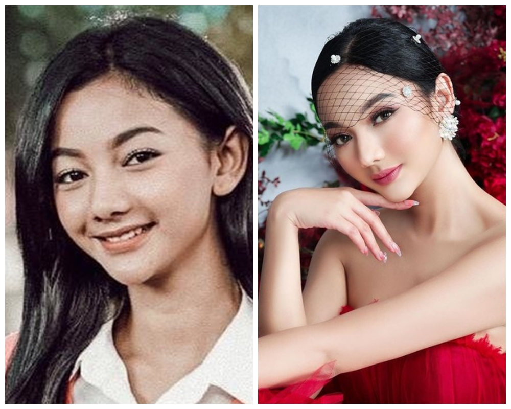 Potret dulu vs kini Glenca Chysara Instagram