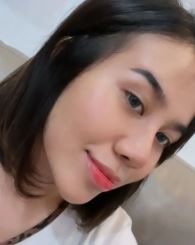 Mayang usai lepas perban operasi © 2022 Instagram Mayang usai lepas perban operasi © 2022 Instagram