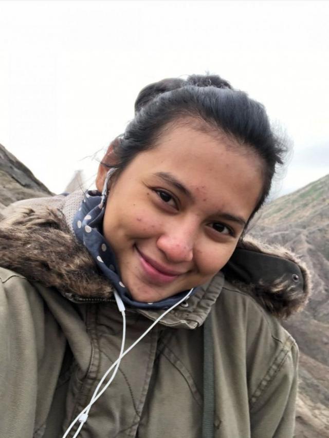 artis pamer wajah berjerawat © Instagram artis pamer wajah berjerawat © Instagram