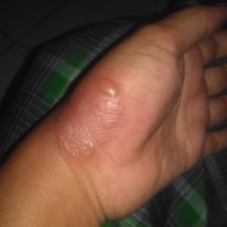 Momen apes saat memasak ini nyeseknya © 2023 brilio.net Momen apes saat memasak ini nyeseknya © 2023 brilio.net