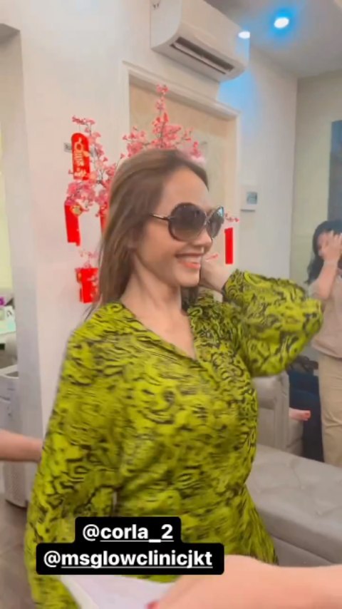 potret terbaru bunda corla usai operasi plastik © instagram