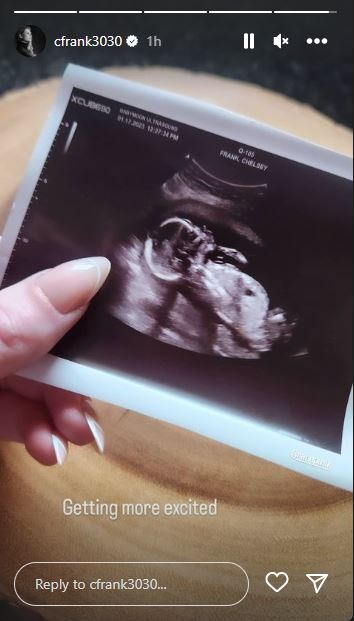 momen gender reveal Randy dan Chelsey © 2022 Instagram momen gender reveal Randy dan Chelsey © 2022 Instagram