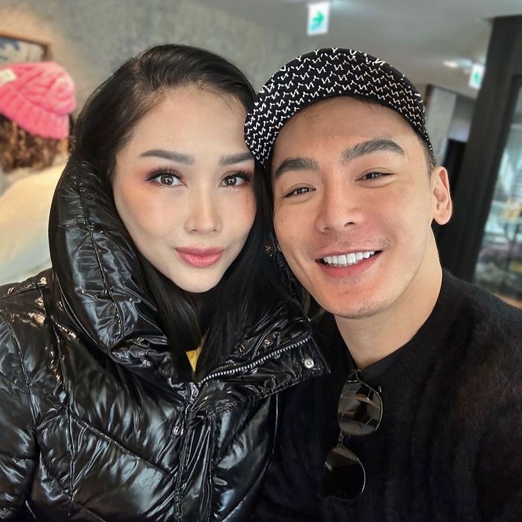 Titi DJ operasi antiaging © berbagai sumber