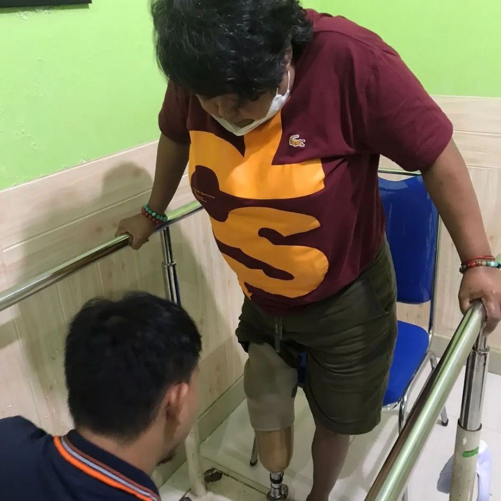Suti Karno mulai bisa berdiri dan berjalan dengan kaki palsu © berbagai sumber Suti Karno mulai bisa berdiri dan berjalan dengan kaki palsu © berbagai sumber