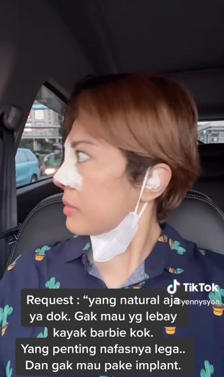 potret terbaru Yenny AFI setelah operasi plastik hidung © 2022 berbagai sumber