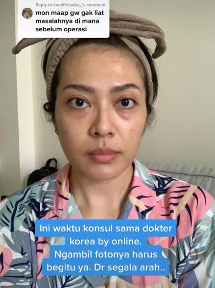 potret terbaru Yenny AFI setelah operasi plastik hidung © 2022 berbagai sumber