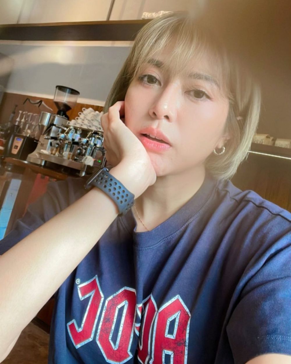 potret terbaru Yenny AFI setelah operasi plastik hidung © 2022 berbagai sumber