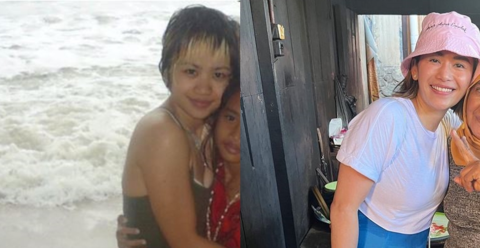 Potret seleb usia 40an tahun sebelum dan sesudah operasi plastik © 2023 brilio.net