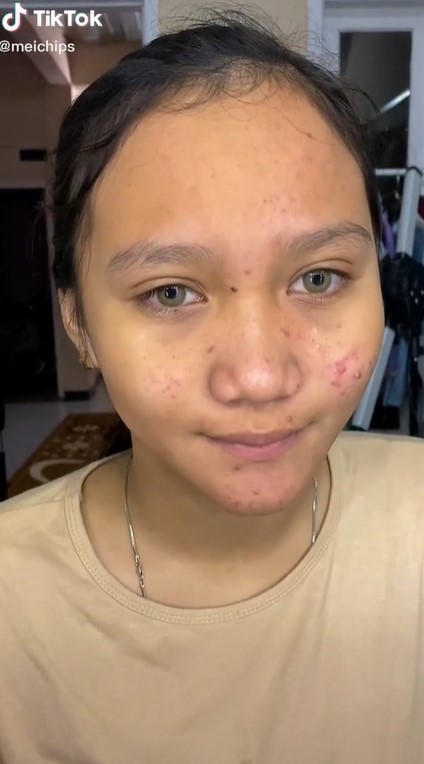 Gadis remaja ini dengan kulit berjerawat di make up MUA © 2023 brilio.net