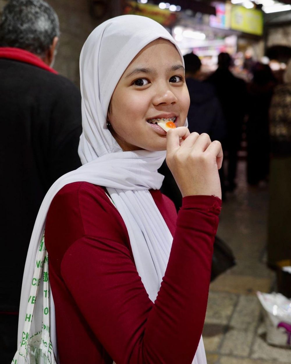 shafeea pakai behel © Instagram