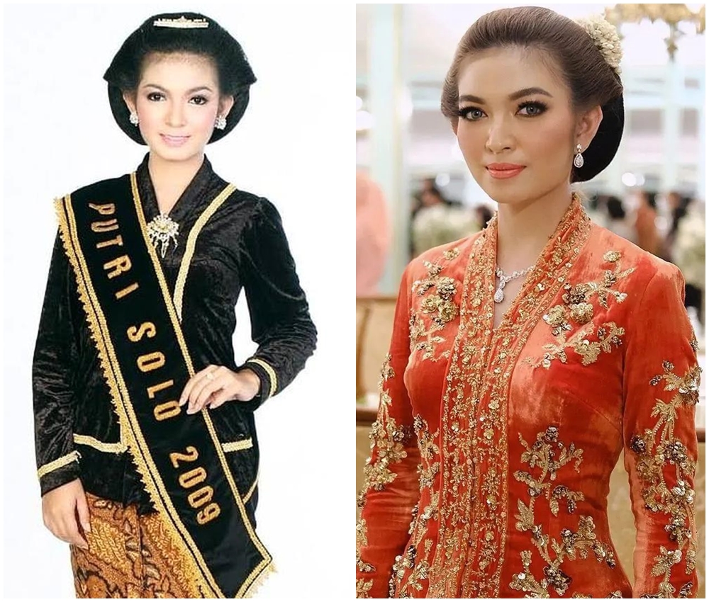 dulu dan kini selvi ananda © Berbagai sumber