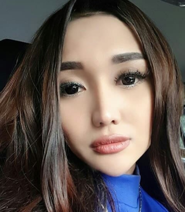 Transformasi Lucinta Luna usai operasi hidung © berbagai sumber