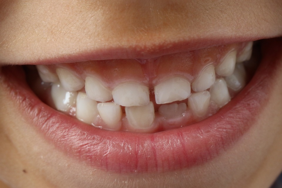 11 Arti mimpi gigi patah, bisa jadi gambaran situasi hidup seseorang