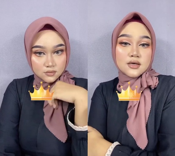 wanita diejek wajahnya kayak telur © Instagram