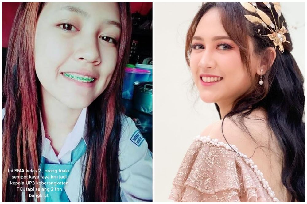 gigi happy asmara © berbagai sumber