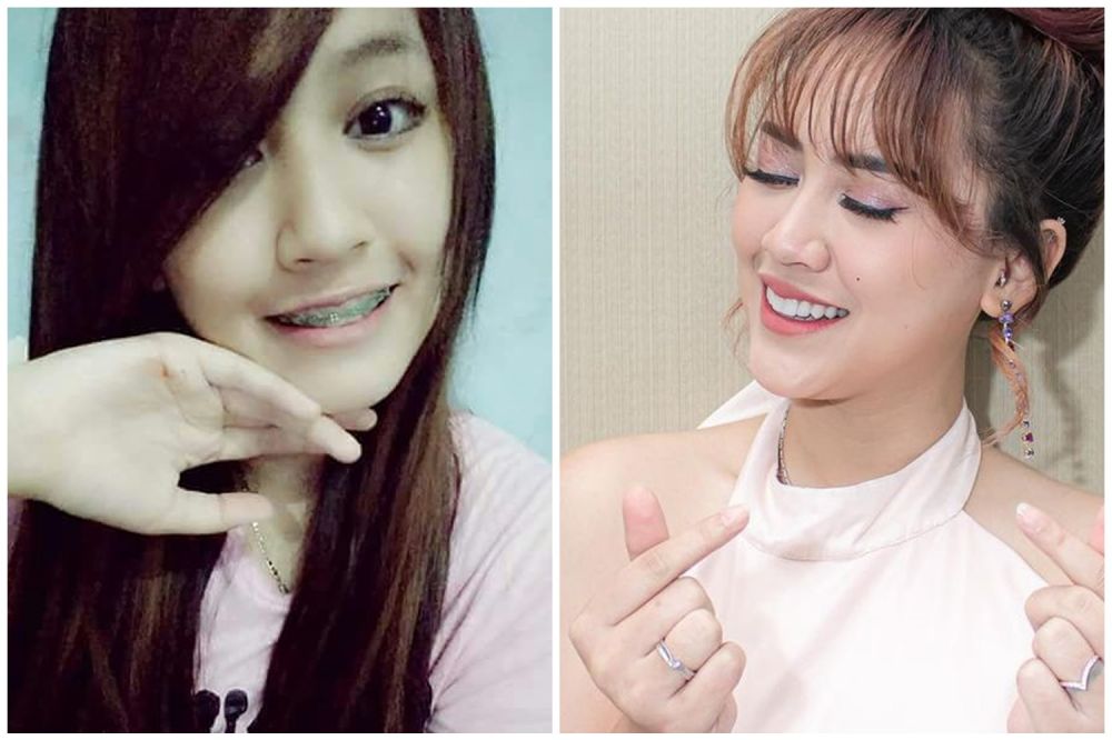 gigi happy asmara © berbagai sumber