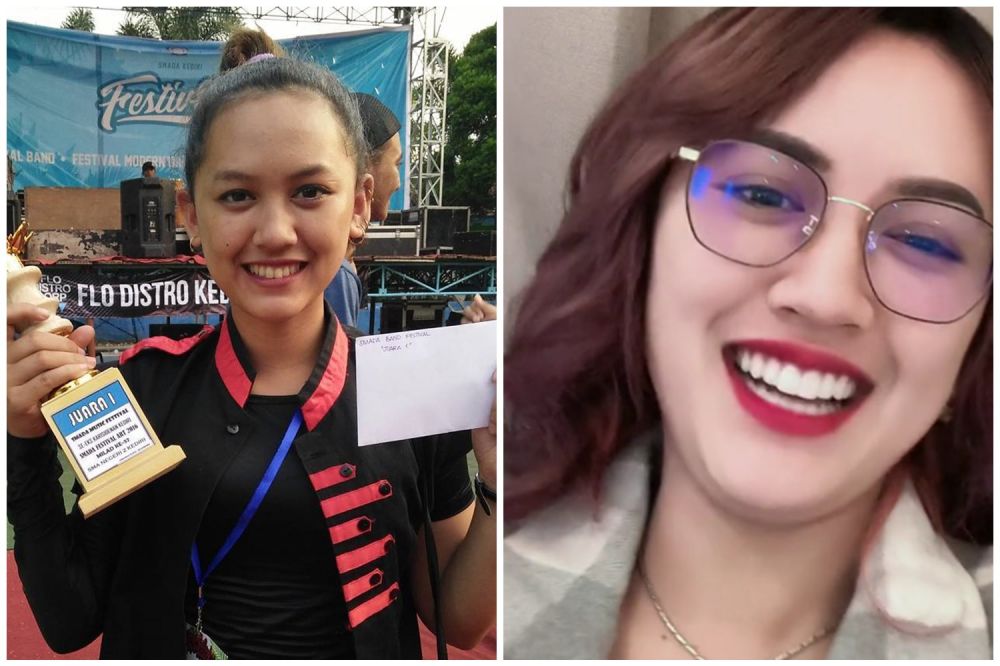 gigi happy asmara © berbagai sumber