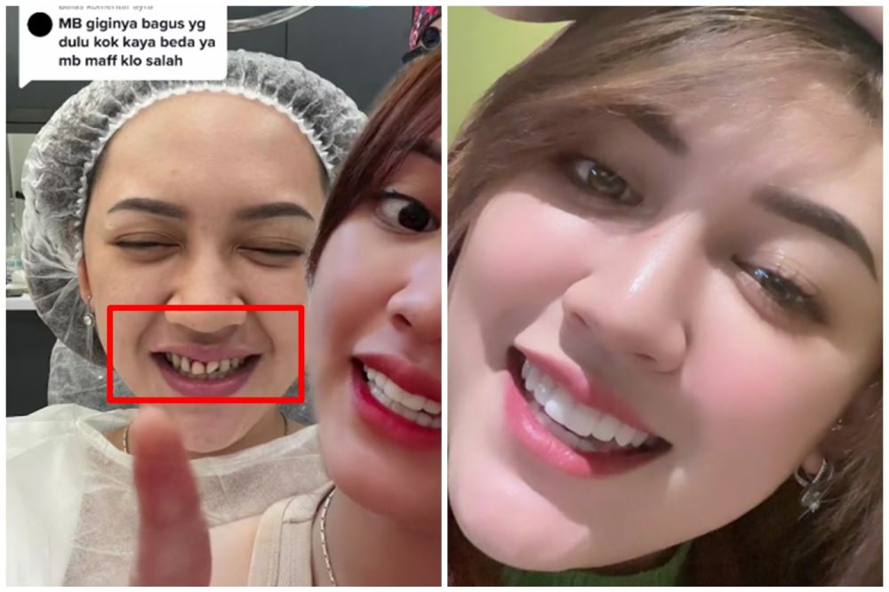 gigi happy asmara © berbagai sumber