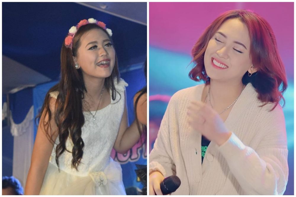 gigi happy asmara © berbagai sumber