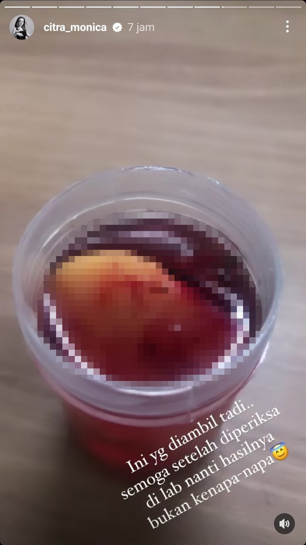 momen ifan seventeen jalani operasi  © instagram