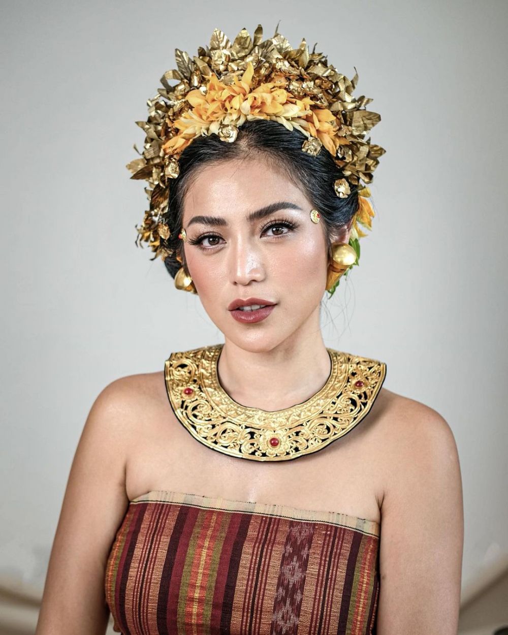 transformasi Jessica Iskandar oplas © berbagai sumber