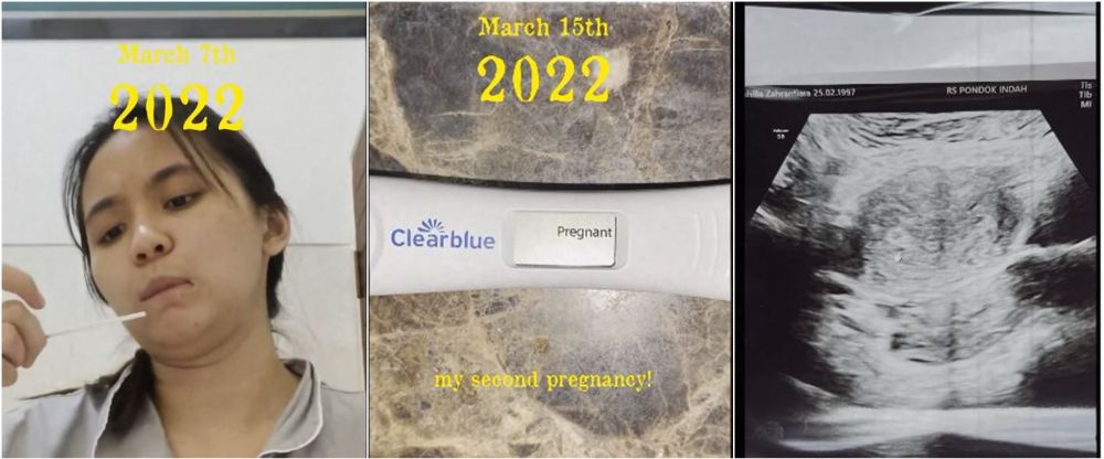 perjuangan ashilla hamil © TikTok